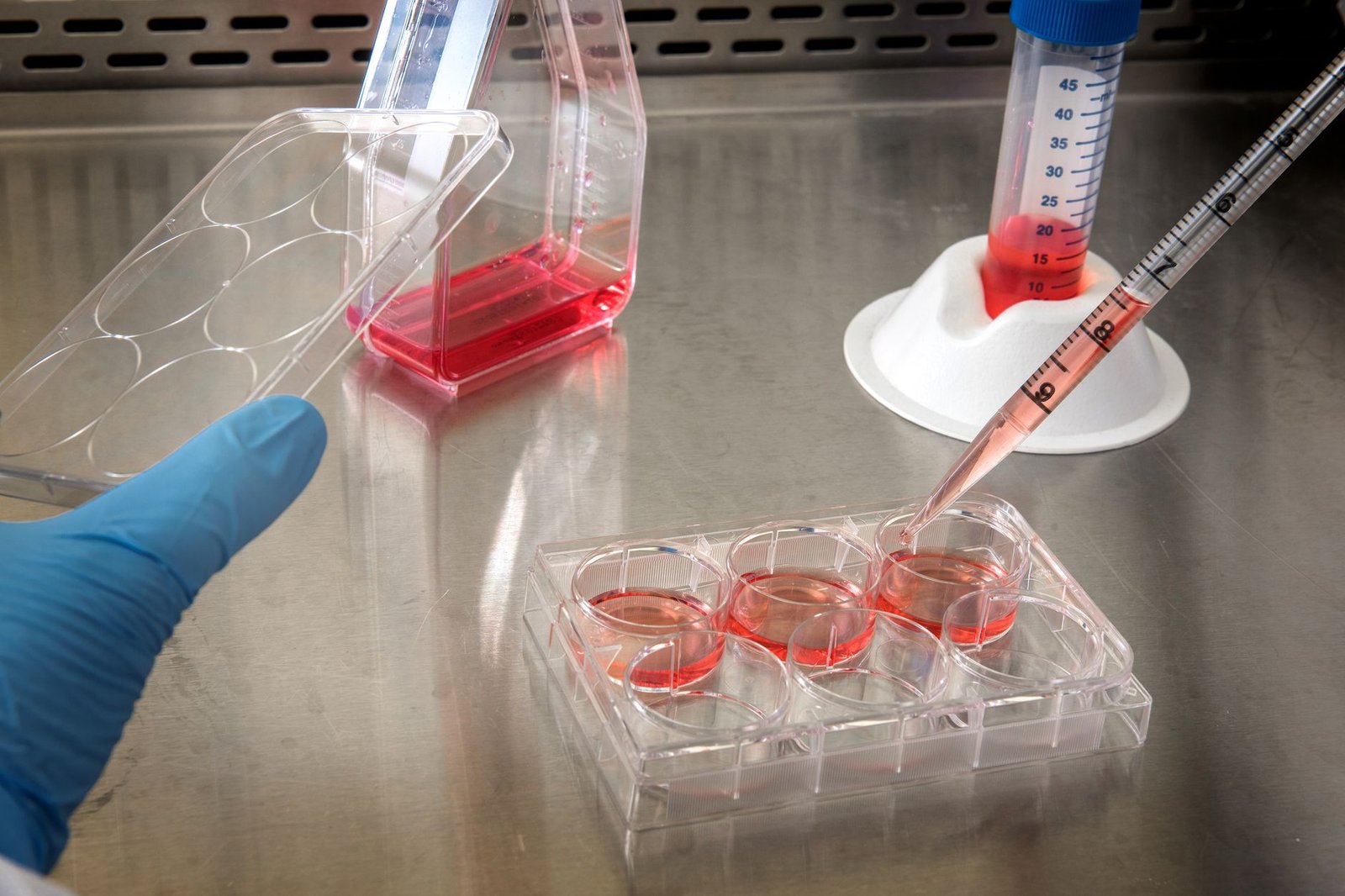Stem cell therapy — post 34
