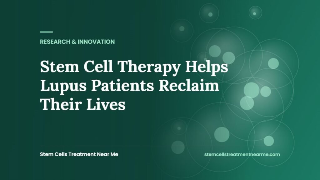 Stem Cell Therapy Helps Lupus Patients Reclaim Their Lives