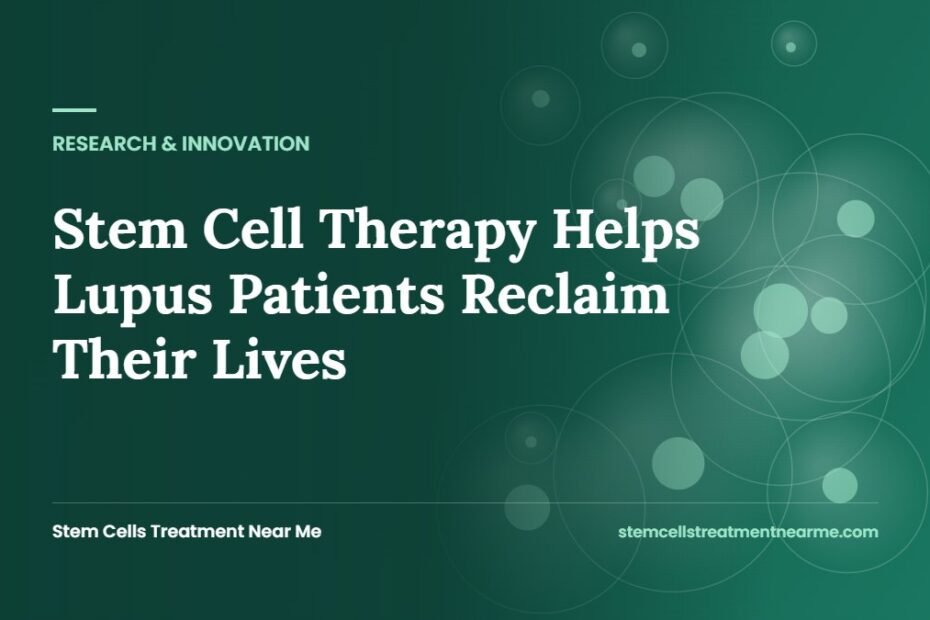 Stem Cell Therapy Helps Lupus Patients Reclaim Their Lives