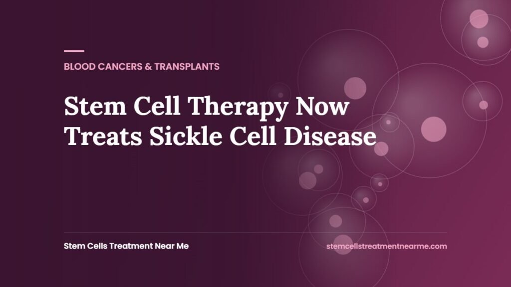 Stem Cell Therapy Now Treats Sickle Cell Disease